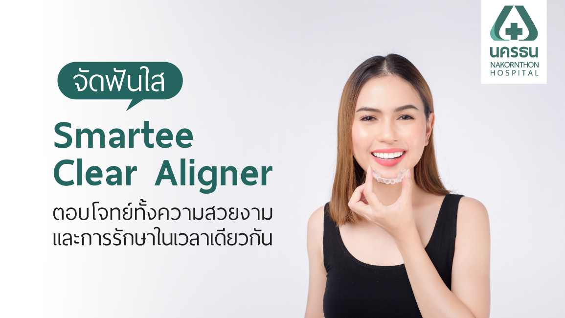 จัดฟันใส Smartee